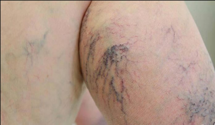 1488513381__kaifzona_ru